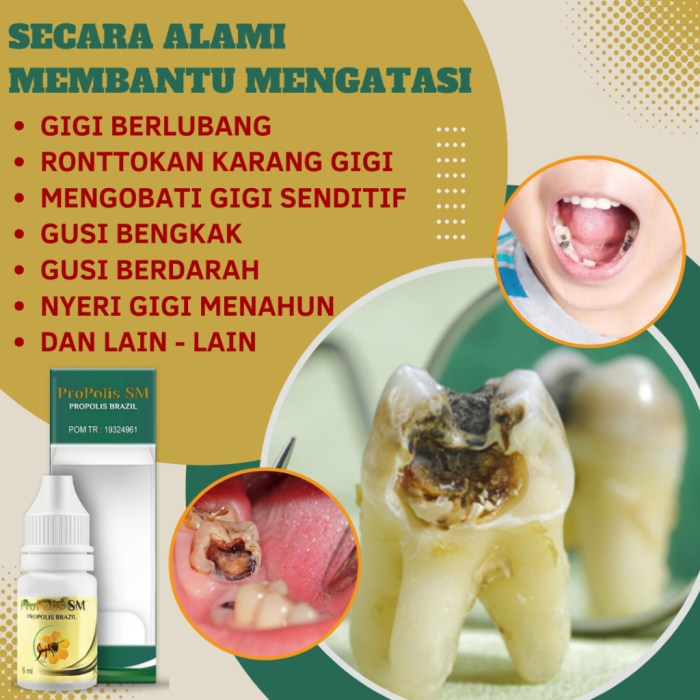 Obat Herbal Gusi Bengkak