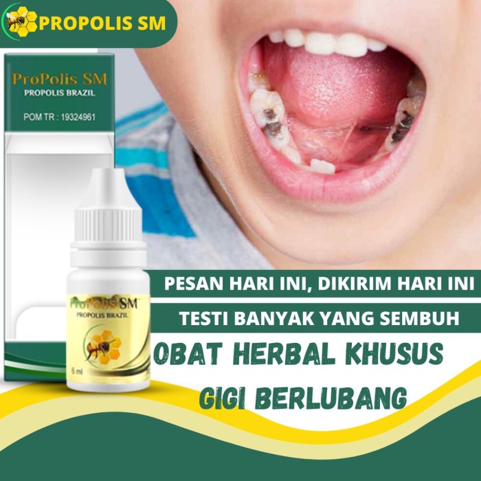 Obat Herbal Gusi Bengkak