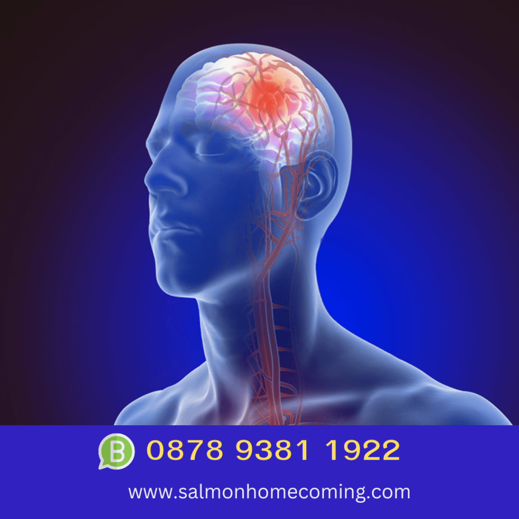 Obat Pengencer Darah untuk Penderita Stroke Solusi Terbaik untuk ... Tekanan Darah Bisa Cegah Stroke Jika Dicek Rutin