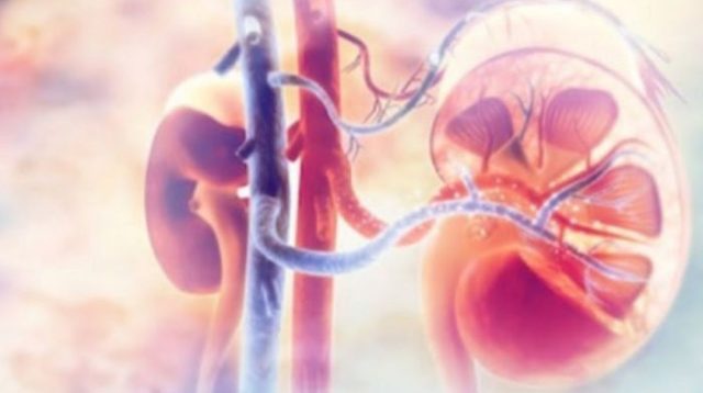 5 Rutinitas Sehari-hari yang Bisa Bikin Gagal Ginjal Datang Diam-Diam