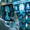 Info Teknologi AI dalam Dunia Kedokteran