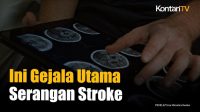 Gejala Awal Stroke yang Perlu Diwaspadai